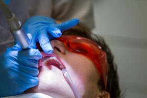 general dentistry FAQs