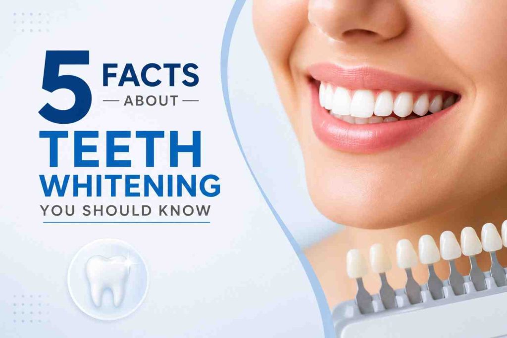 5 Facts About Teeth Whitening You Should Know